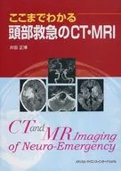 到目前為止所了解的頭部急救的CT·MRI