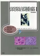 Tumor de cabeza y cuello 1