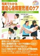 Cuidado del niño severamente retrasado (persona) que se puede ver en la fotografía